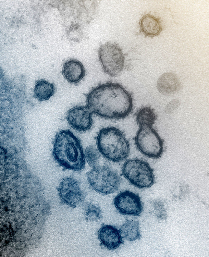 Noul coronavirus s-ar fi putut răspândi în China încă din luna august a anului 2019