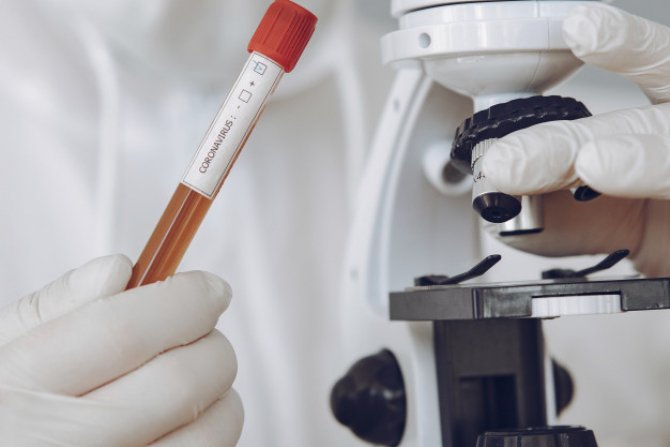 Majoritatea statelor UE NU vor să suporte costurile testelor PCR pentru certificat verde digital