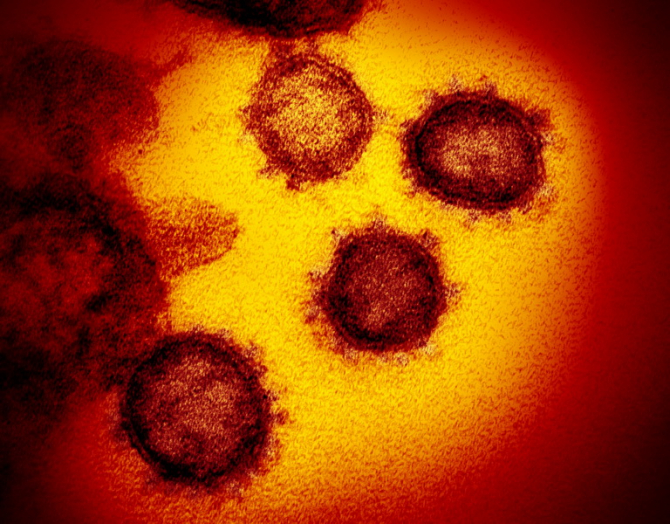 SARS-CoV-2 atacă direct sistemul imunitar