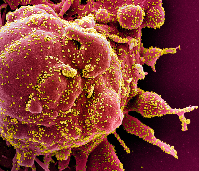Cercetătorii vor să elimine ”foarfeca” moleculară care paralizează sistemul imunitar al oamenilor