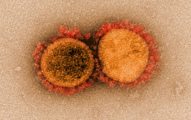 SARS-CoV-2 poate fi combătut și cu alte coronavirusuri