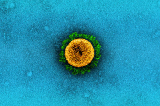 SARS-CoV-2 văzut la microscop