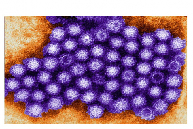 Norovirusul provoadă diaree și vărsături